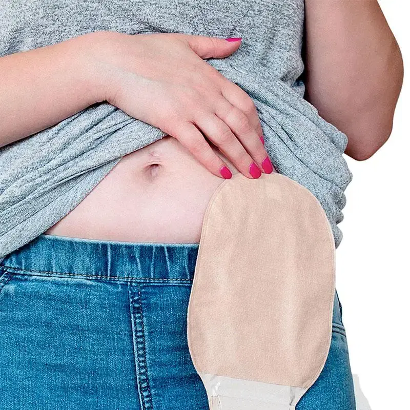 Bolsa de colostomía_2