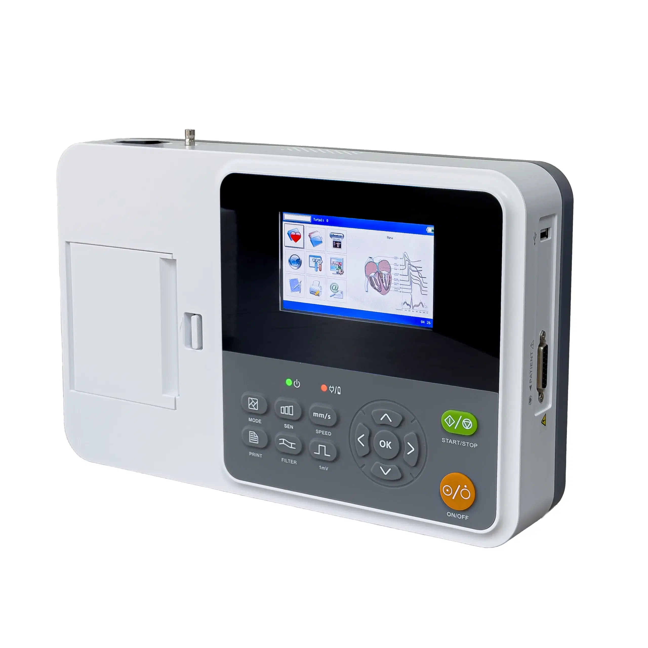 1_electrocardi_grafo_e3