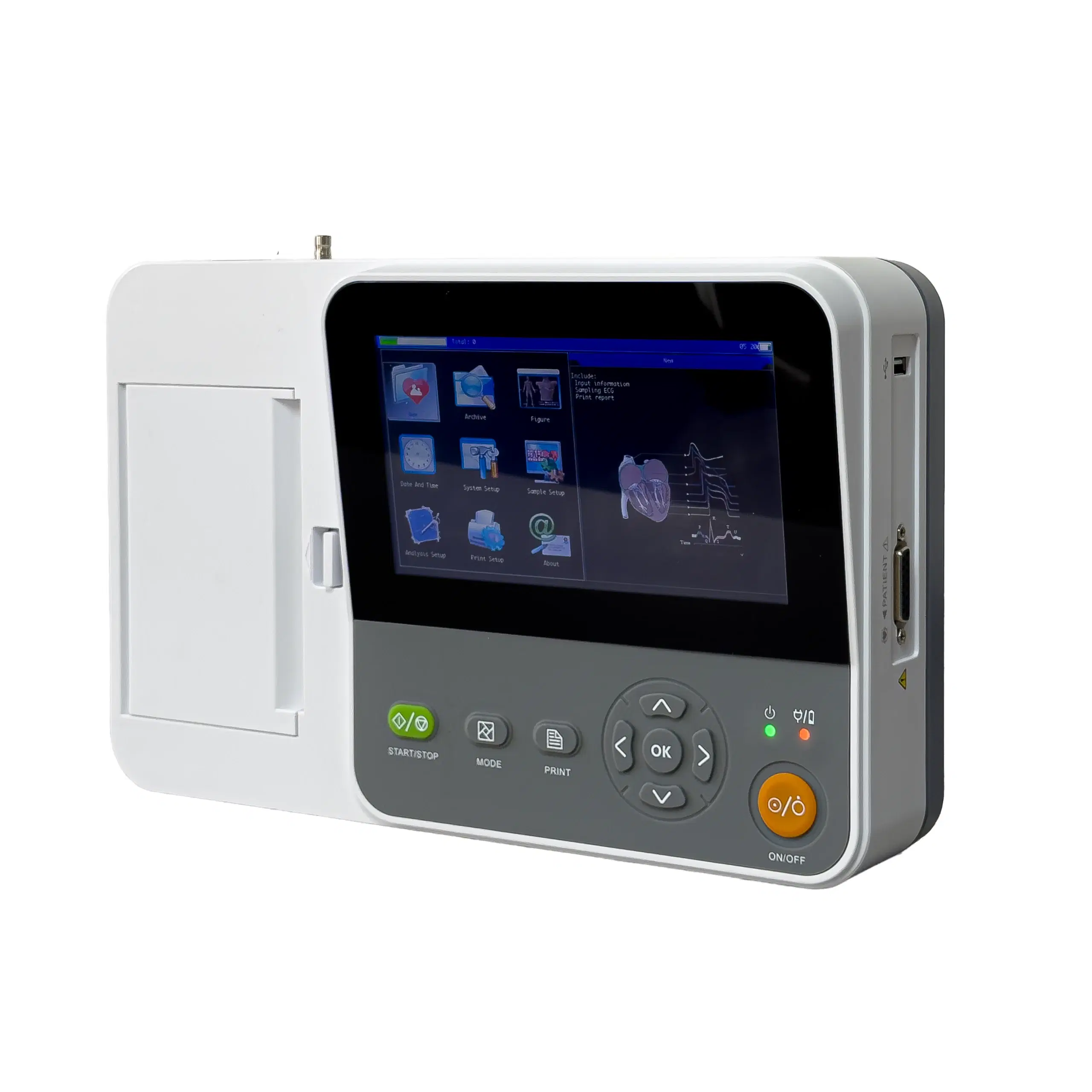 3_electrocardi_grafo_e6